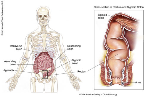 Colorectal