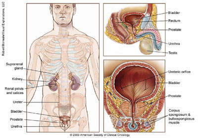 Prostate cancer